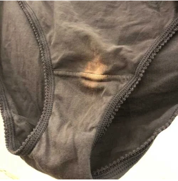 This is what it means if you find a “bleach” spot on your underwear