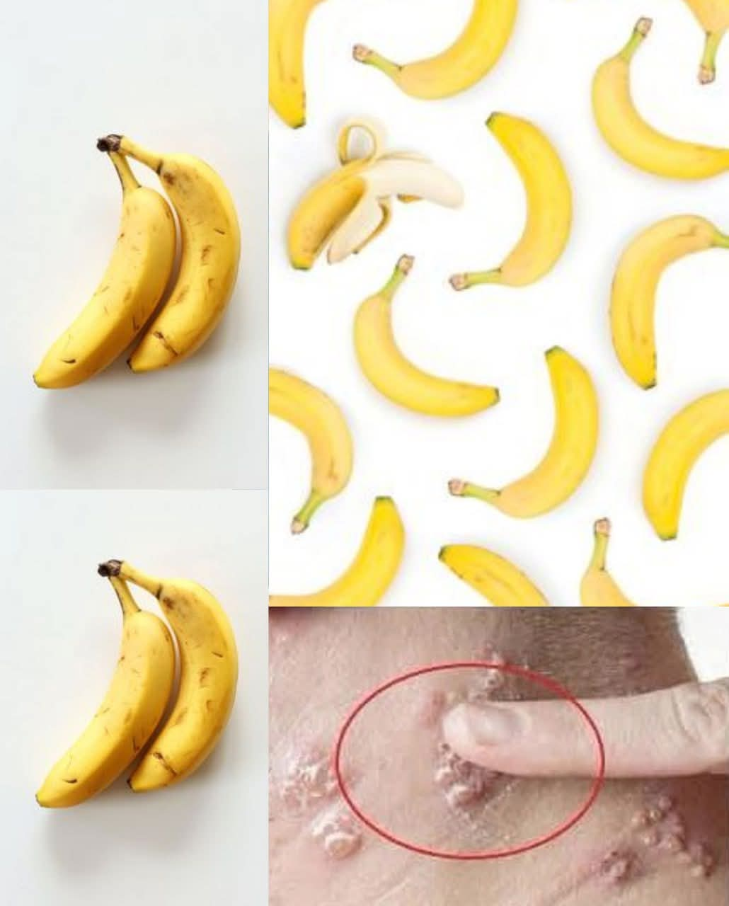 Did You Know That If You Eat a Banana Every Day, Your Body Can…