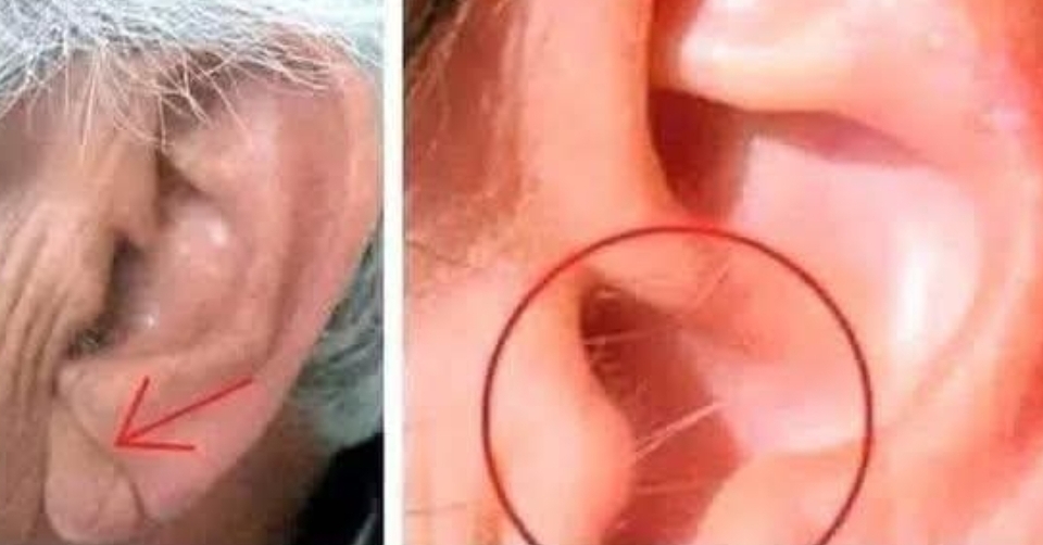 Did you know that if your ear hairs grow, it is because your body is