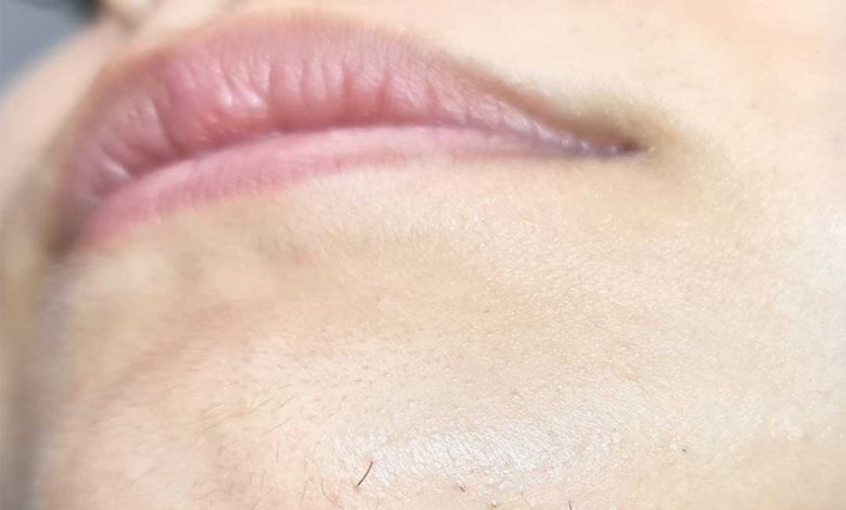 Chin Whiskers