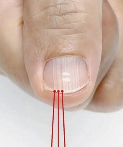 What Those Vertical Lines on Your Nails After 40 Could Be Telling You